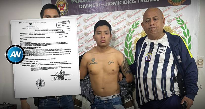 ¡No fue "torturado"! Examen médico revela que “Cortadedos” se lesionó al huir de la Policía