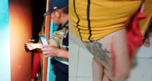 Mujer termina con corte en la pierna tras presunta agresión en Huanchaquito Alto