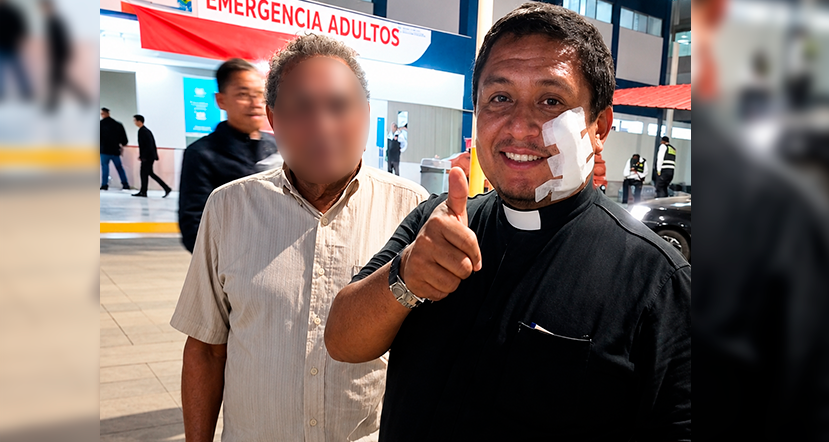 Sacerdote se salva de milagro tras recibir un disparo en el rostro en el Callao